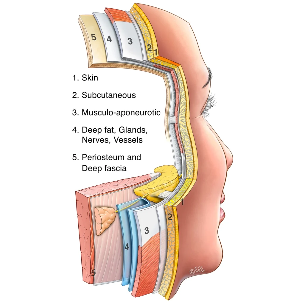 Deep Plane Facelift - o2 Clinic