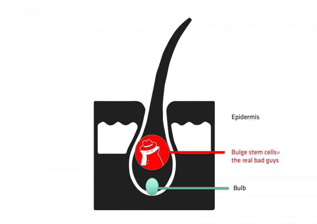 Elektrolyse ontharing - o2 Clinic