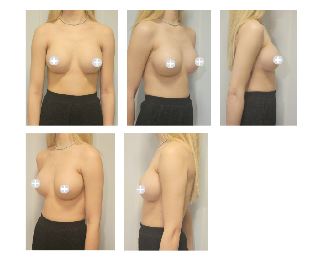 Preparation for your consultation - o2 Clinic