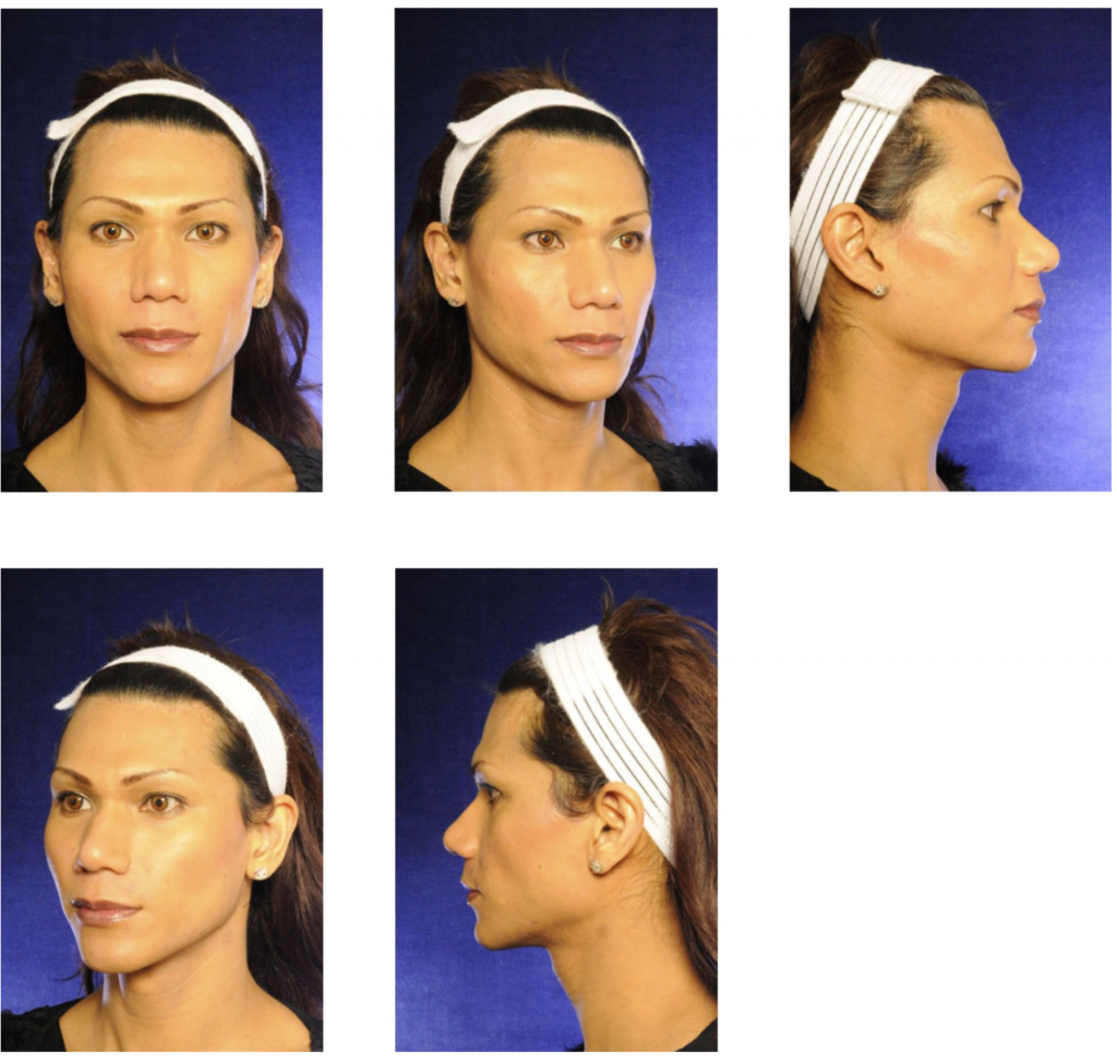 Preparation for your consultation - o2 Clinic