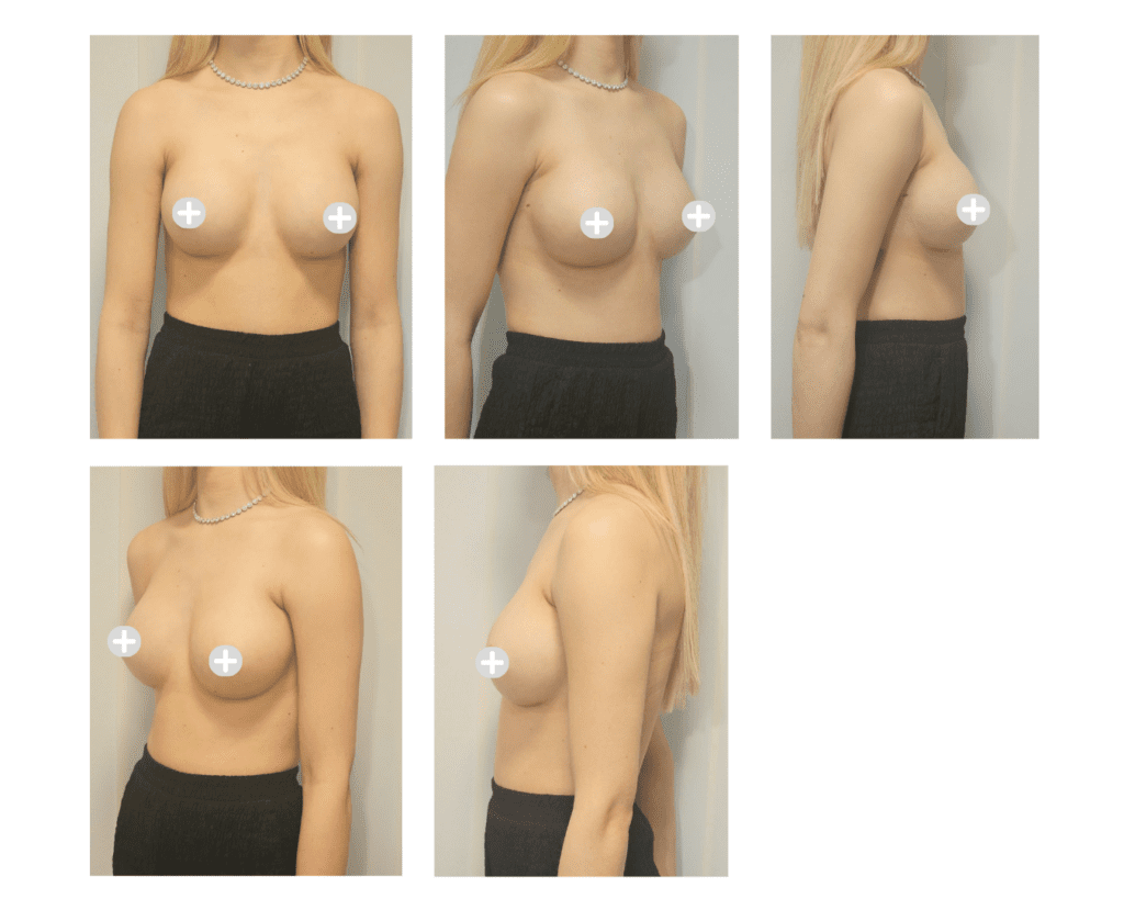 Preparation for your consultation - o2 Clinic